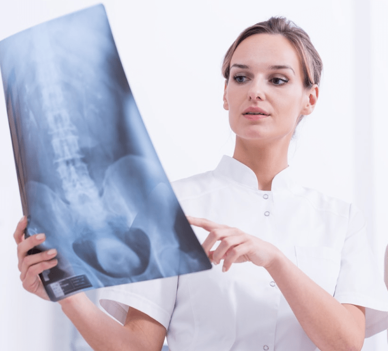 Diagnos vun der thoracescher Osteochondrose duerch Röntgenuntersuchung